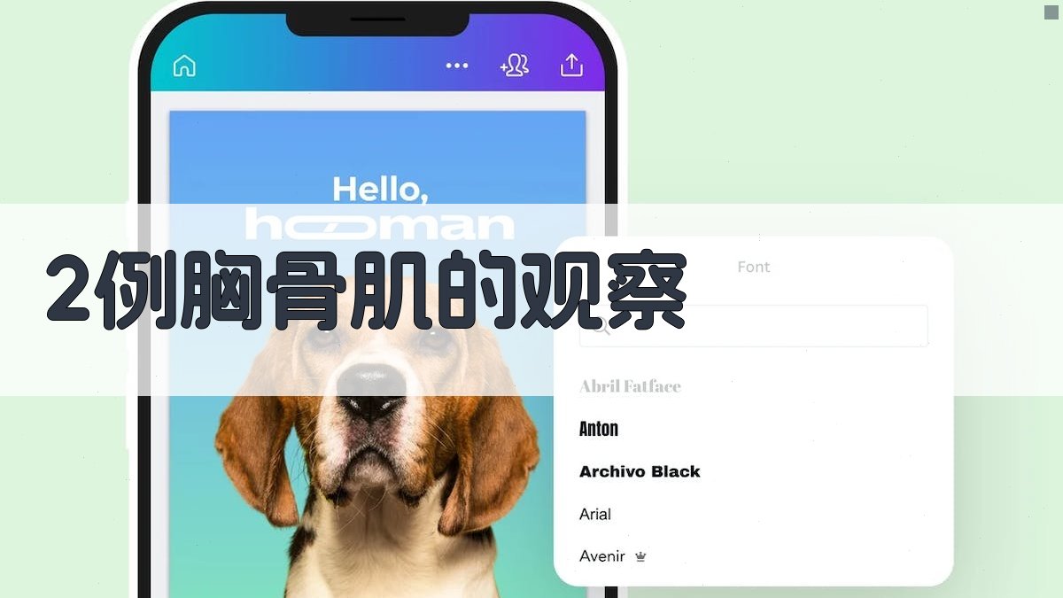 2例胸骨肌的观察