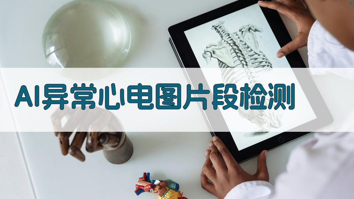 基于多尺度融合改进UNet的异常心电图片段检测研究助手