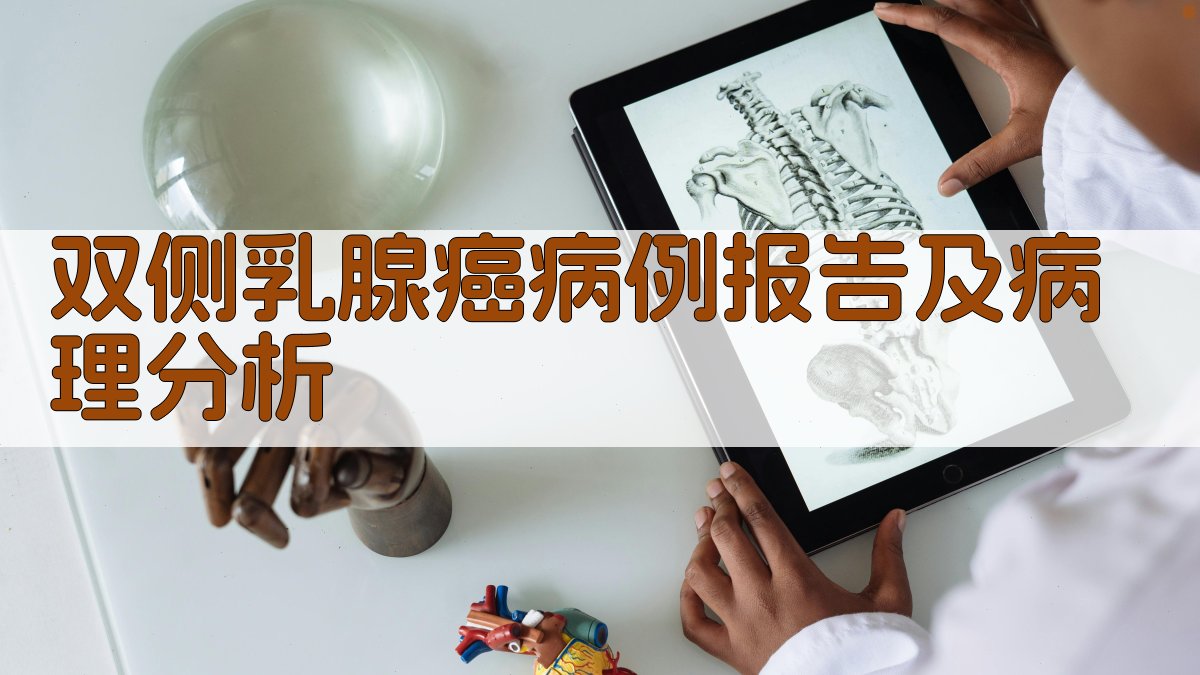 双侧乳腺癌病例报告及病理分析