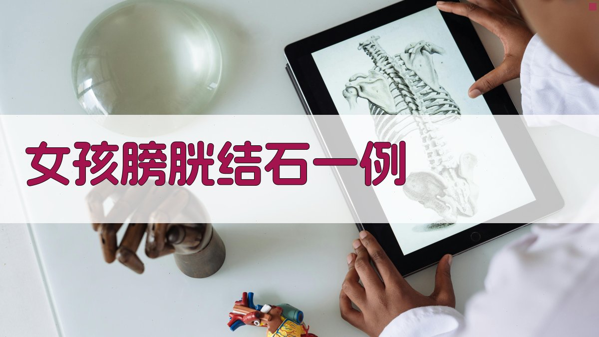 女孩膀胱结石病例分析
