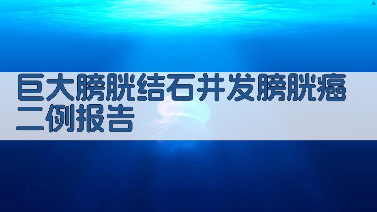 巨大膀胱结石并发膀胱癌病例分析