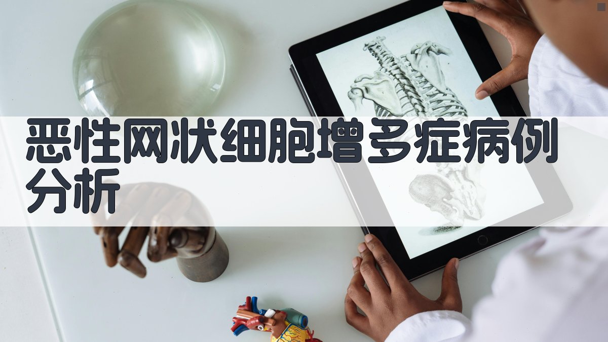 AI恶性网状细胞增多症病例分析