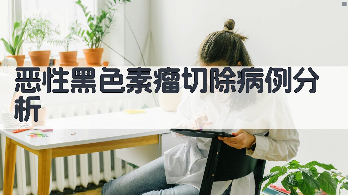 恶性黑色素瘤切除病例分析