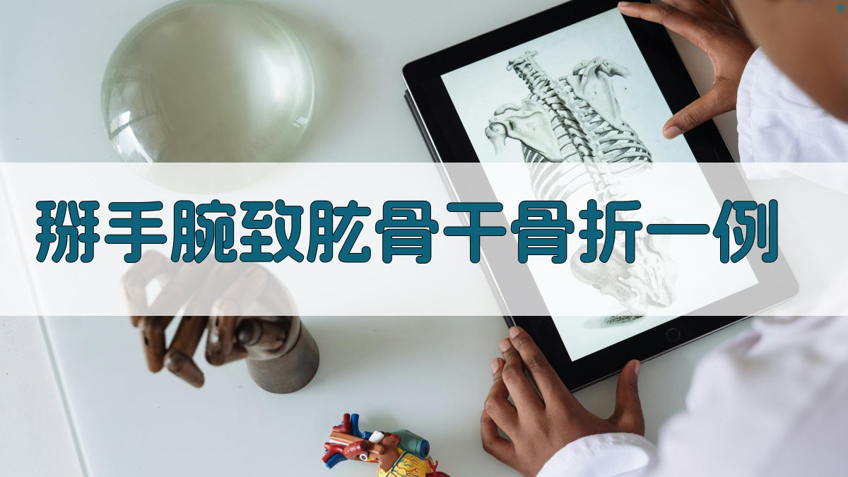 掰手腕致肱骨干骨折一例