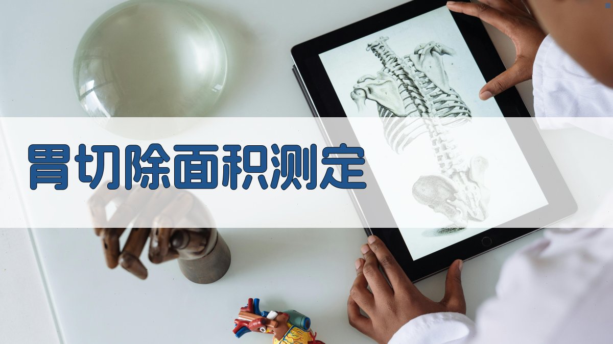 AI智能胃切除面积测定计算工具